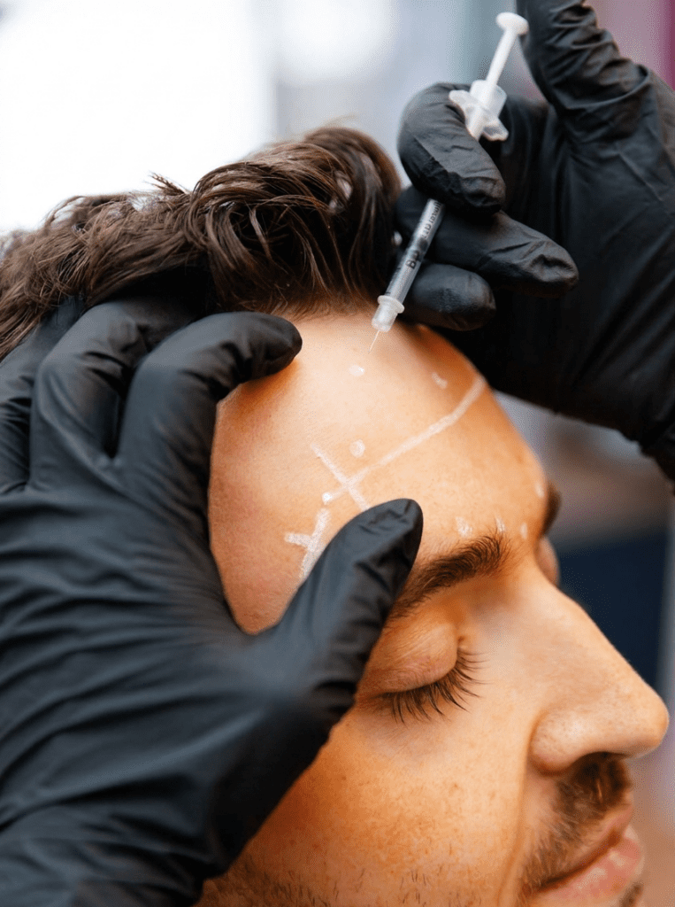 Botox and medical aesthetics treatment in Elora Ontario